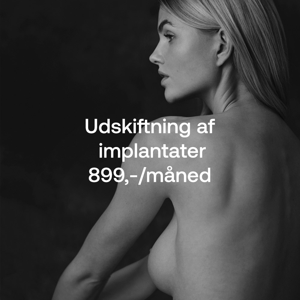 Udskiftning af implantater