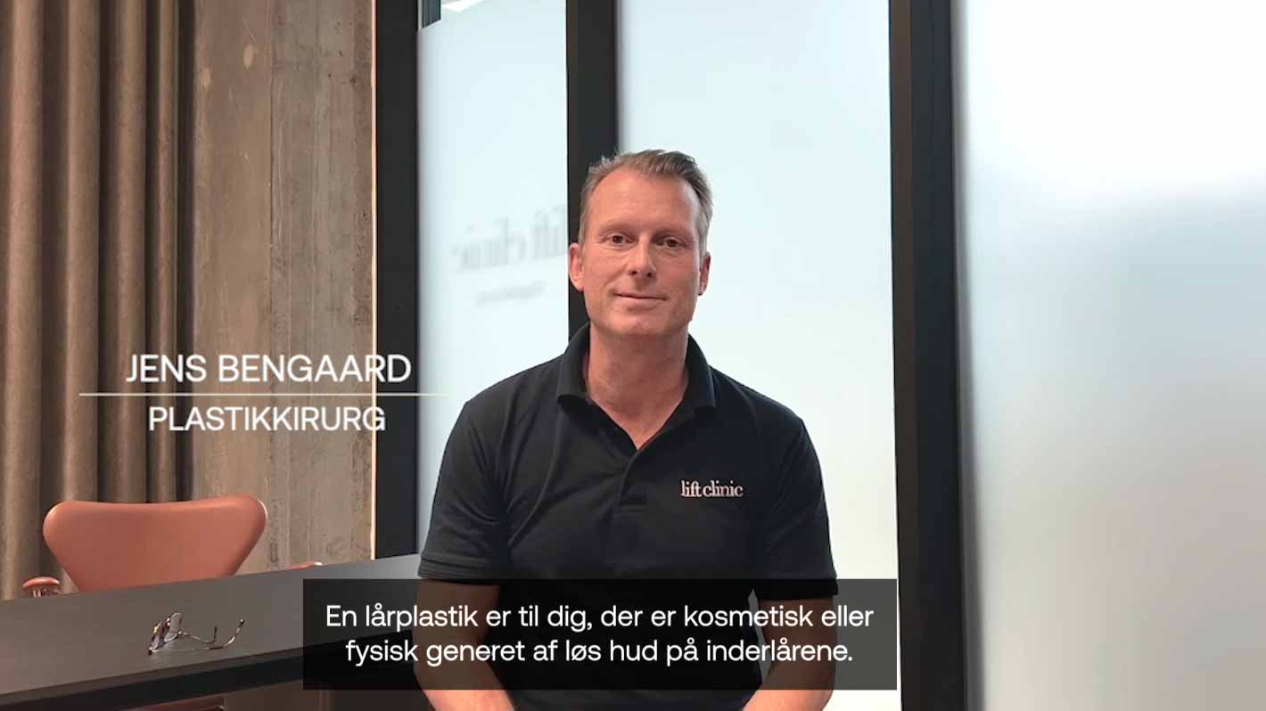 BFO forundersøgelse