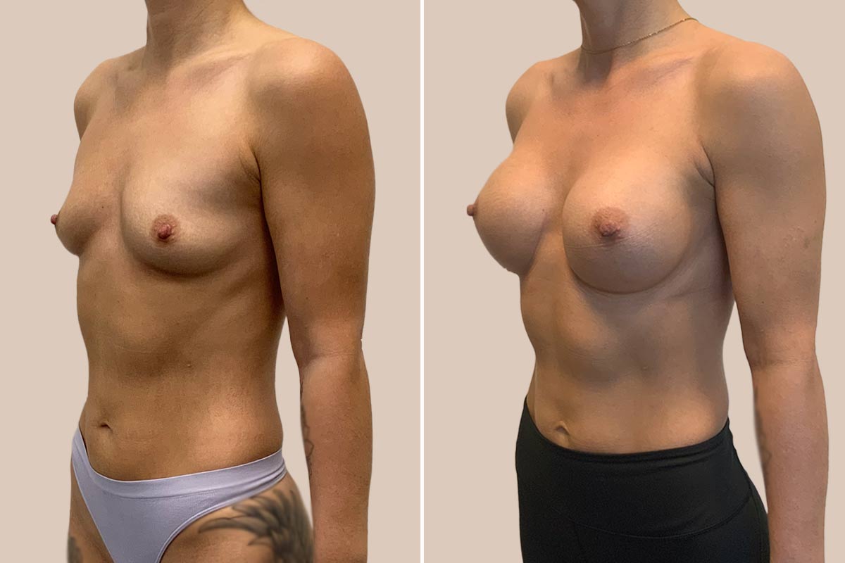 BFO: Motiva Ergonomix, full 375 ml.