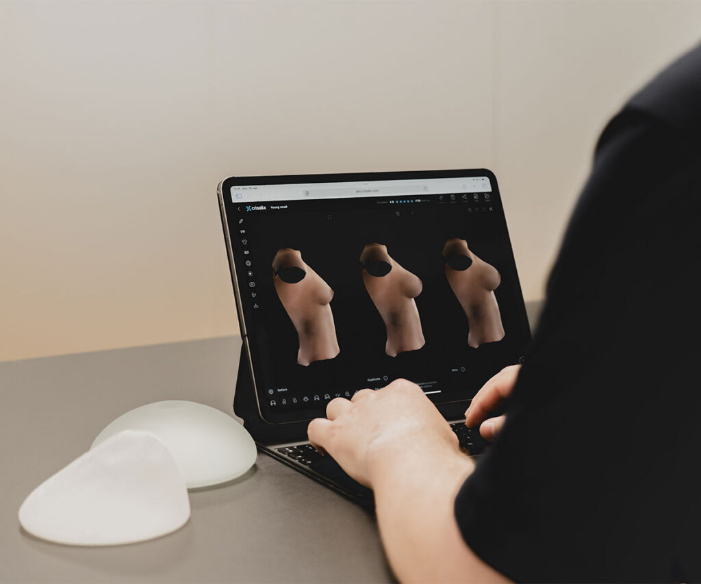 Crisalix 3d simulering