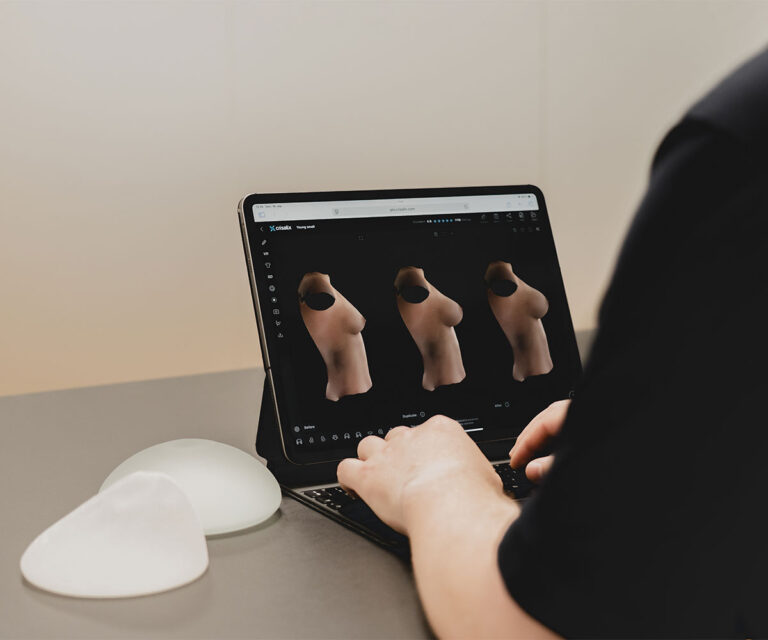 Crisalix 3d simulering