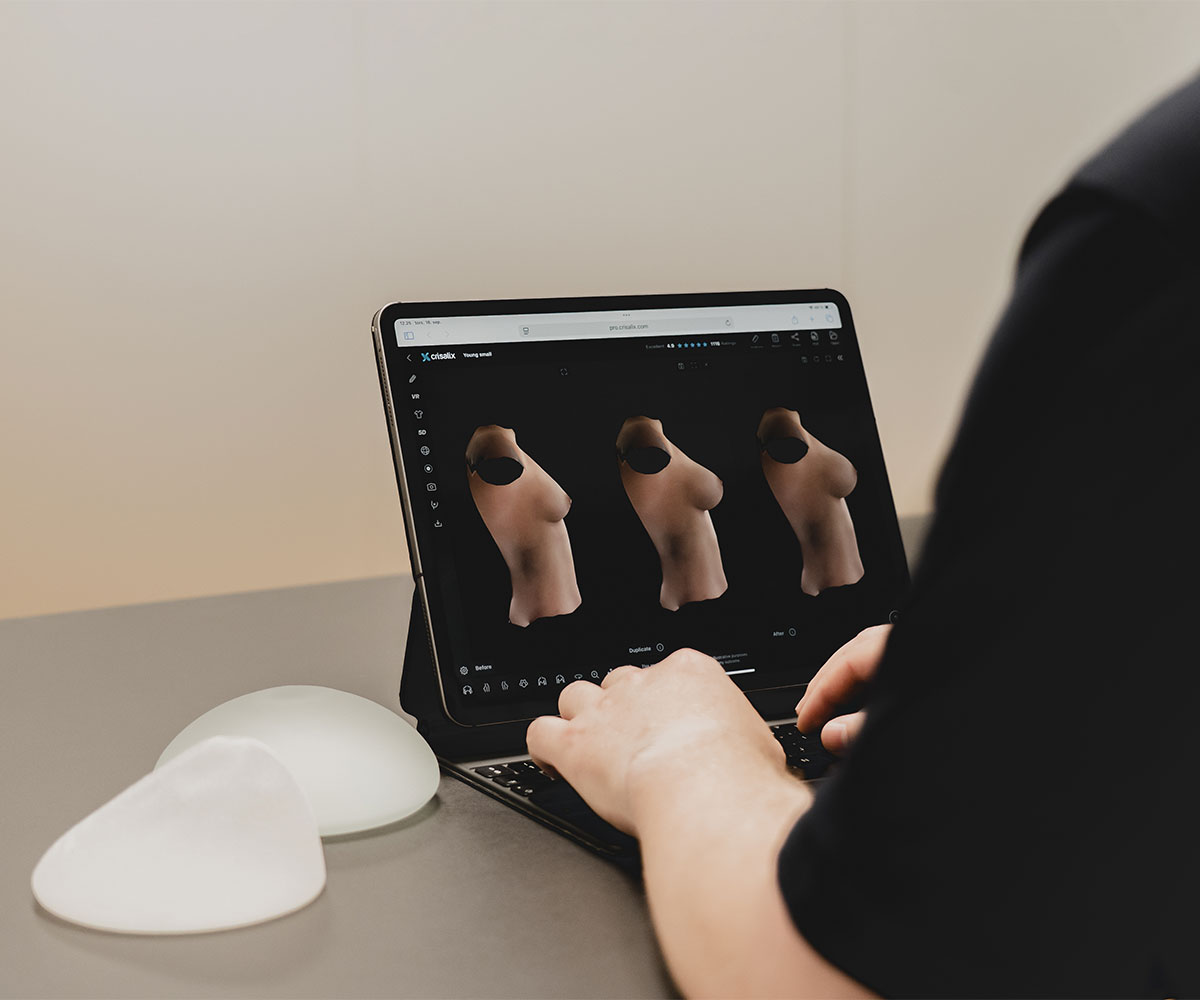 Crisalix 3d simulering